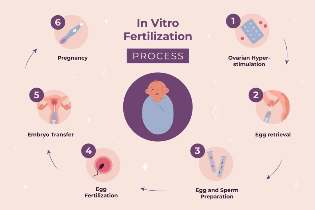 IVF Process Step By Step